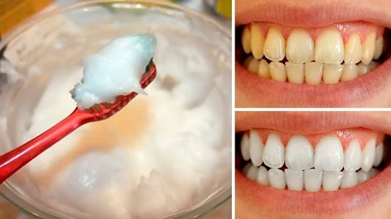 خلطات طبيعية لتبييض الأسنان